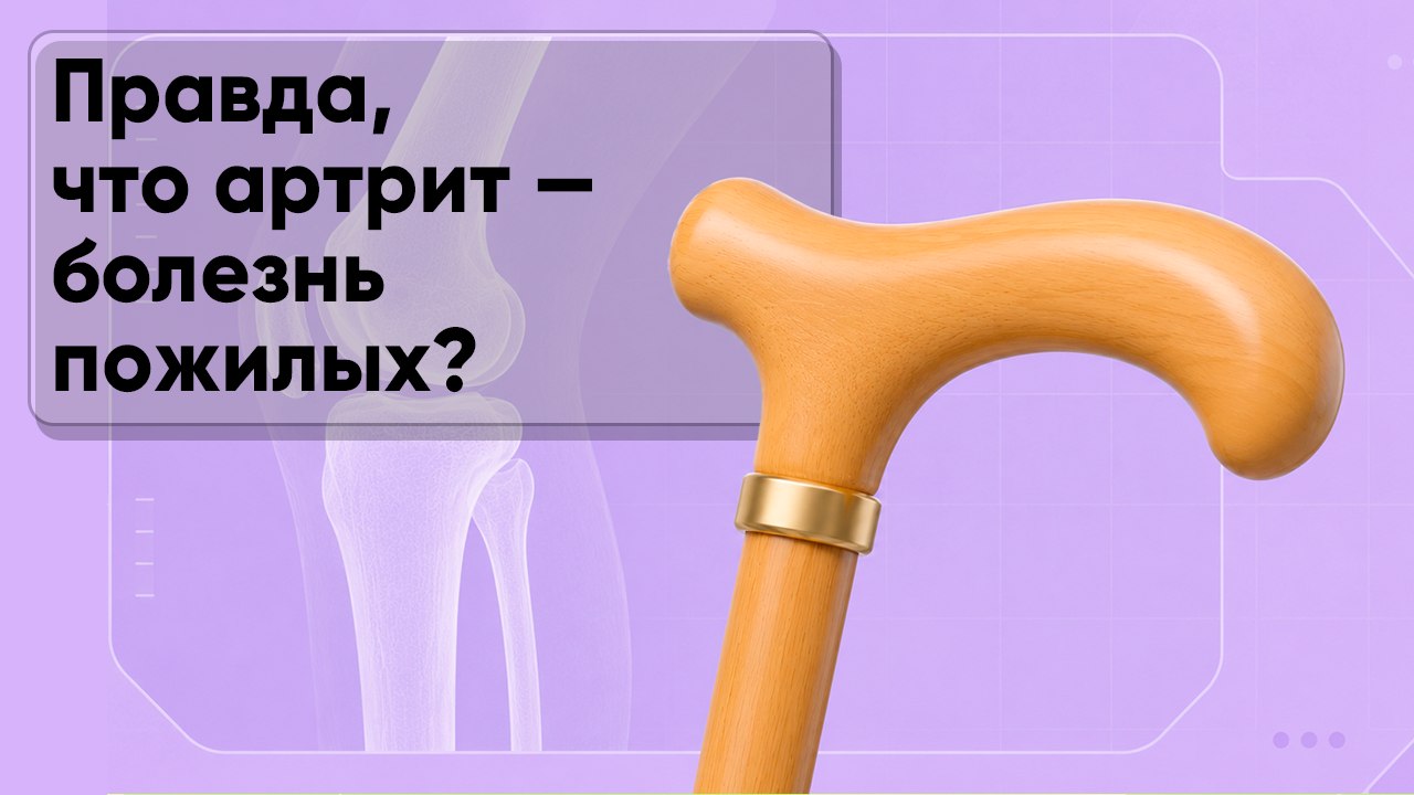 Правда, что артрит — болезнь пожилых?