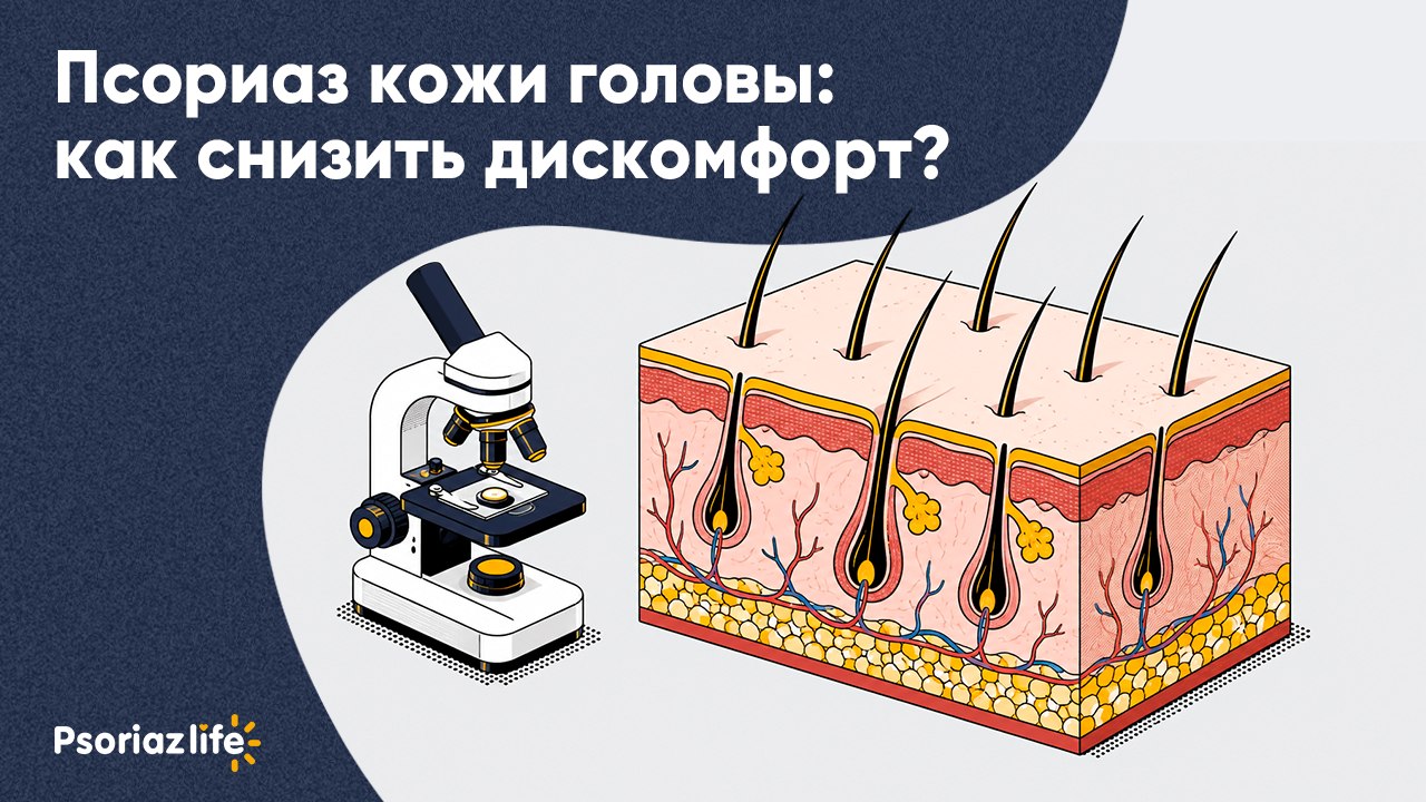 Psoriaz Life — канал для людей с псориазом. Полезные советы, статьи от медэкспертов и вебинары