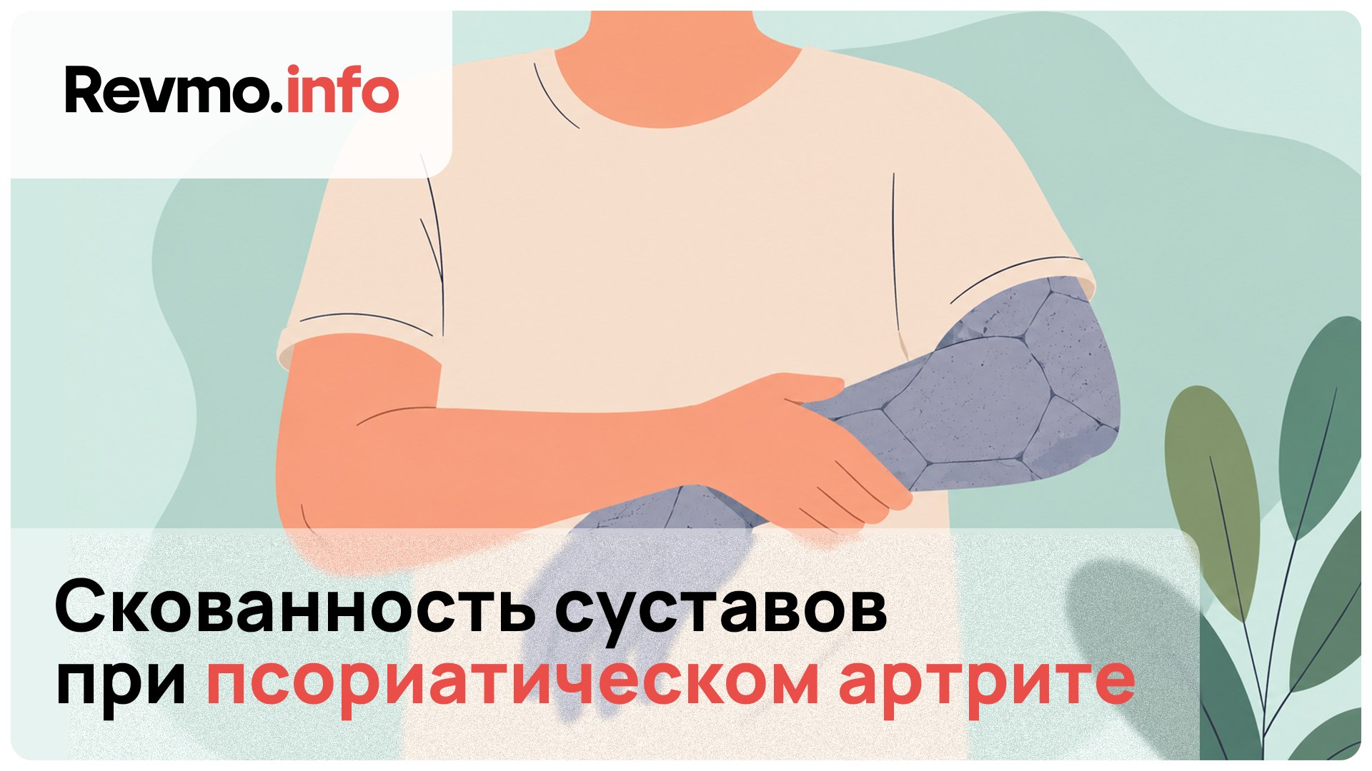 Revmo.info — Ревматоидный, аксиальный спондило- и псориатический артрит, системная склеродермия