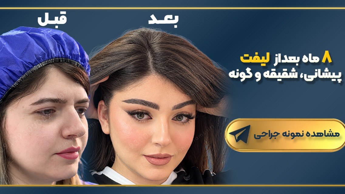 دکتر شاهین شمس | متخصص جراحی زیبایی صورت و لیفت