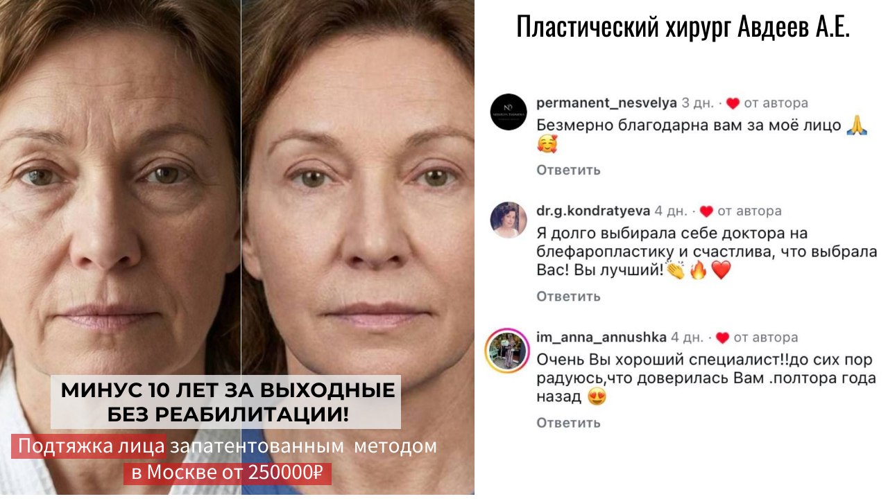 Минус 10 лет за выходные
