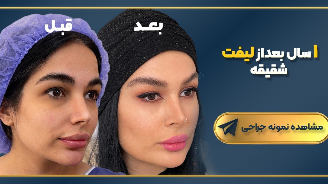 دکتر شاهین شمس | متخصص جراحی زیبایی صورت و لیفت