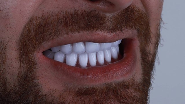 دندانسازی | دندان مصنوعی دیجیتال | کلینیک دندانپزشکی هایدنت