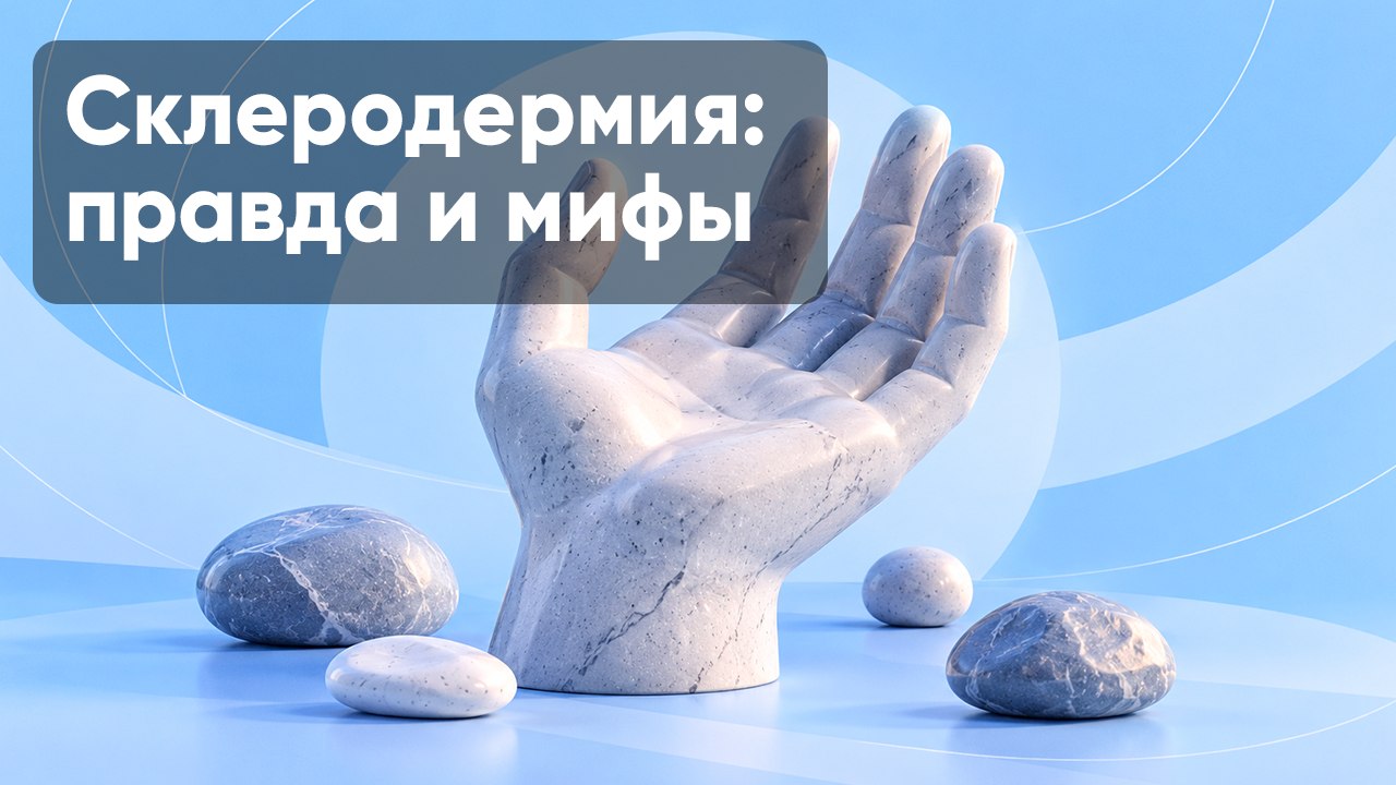 5 мифов о склеродермии