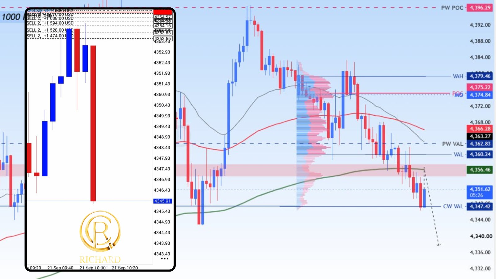 Richard 1000 Pips & More