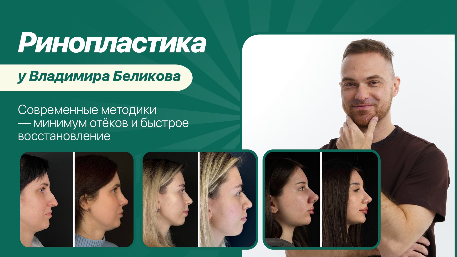 Ринопластика • Блефаропластика • Маммопластика • Беликов