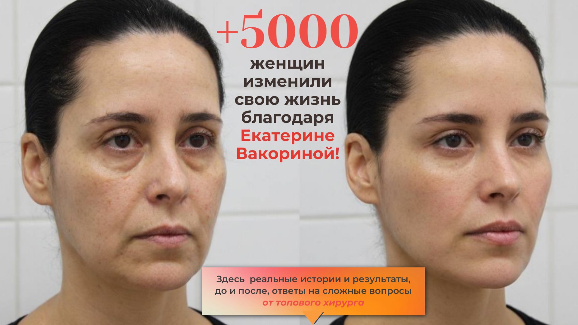 Екатерина Вакорина | Пластический хирург