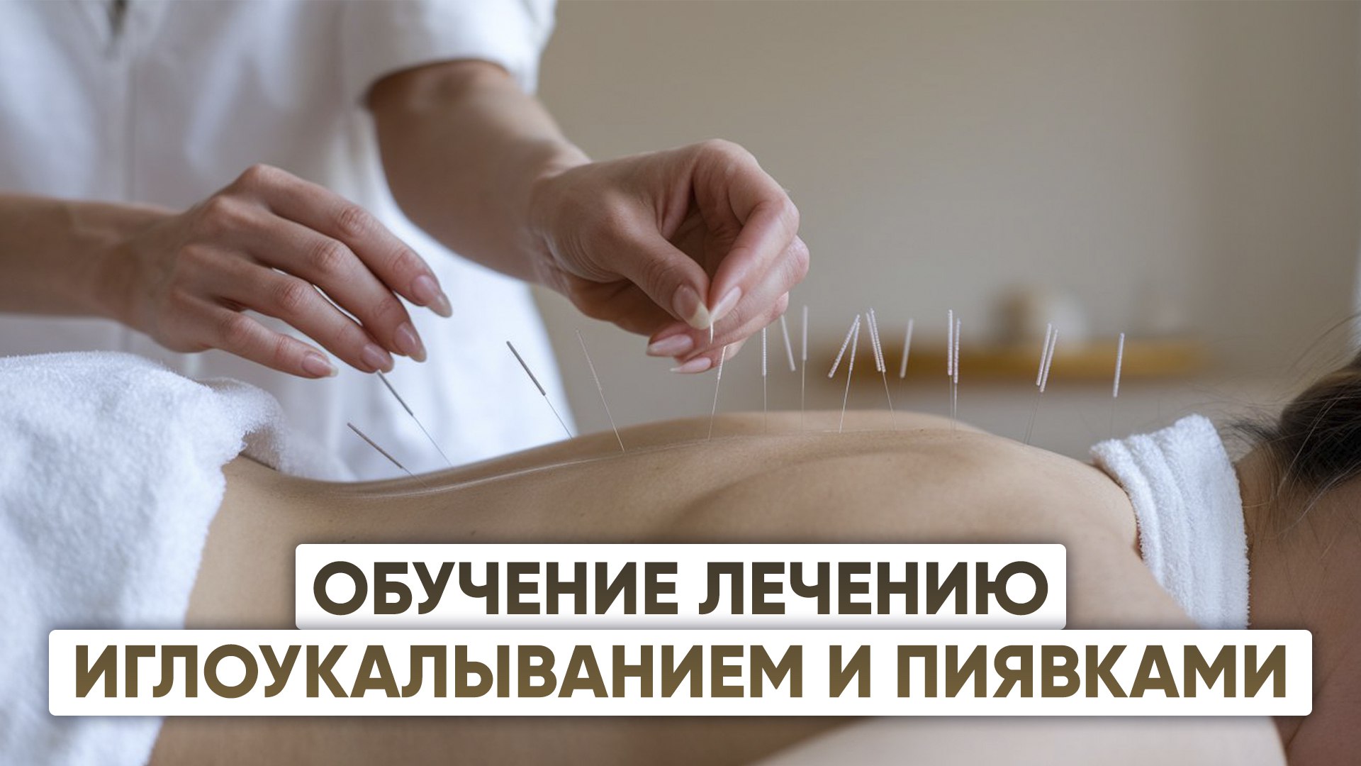 Импульсная игла Шалашовой
