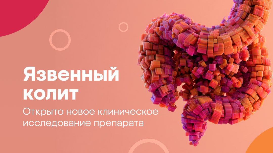 Язвенный колит: исследования